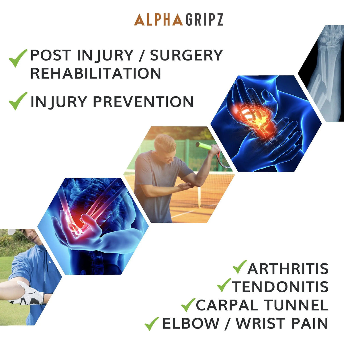 ALPHA GRIPZ™ - Extensor Trainers-3