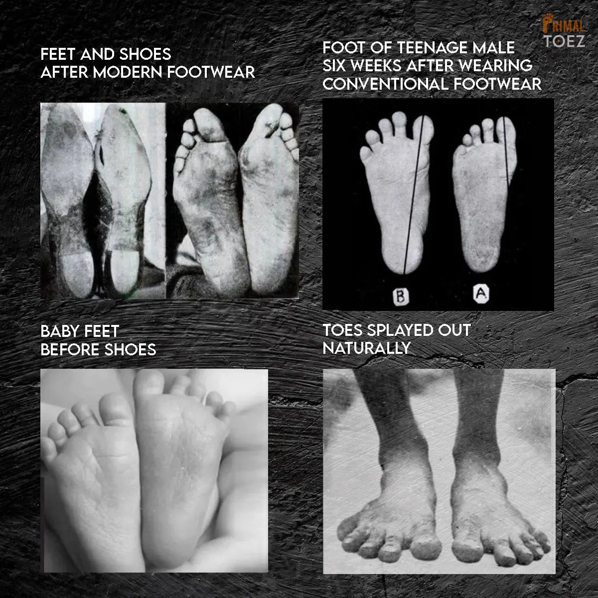 Primal Toez™ 'Walkabouts' - Active Toe Spacers-2