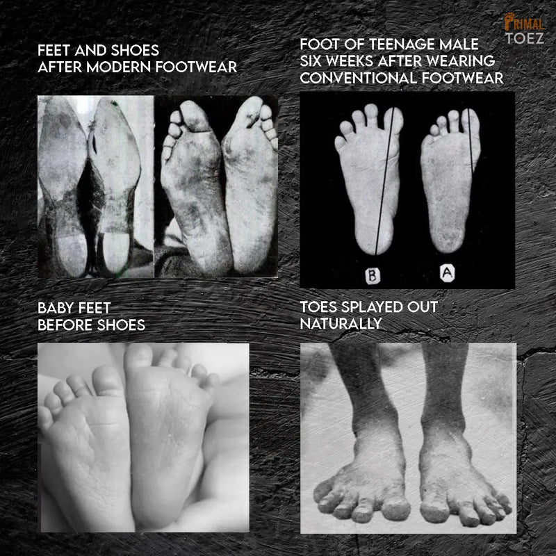 Primal Toez™ 'Walkabouts' - Active Toe Spacers-2